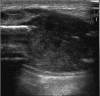 Figure 1a