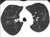 Figure 1c
