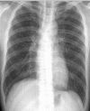 Figure 1b