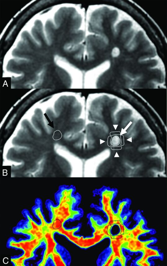 Fig 2.