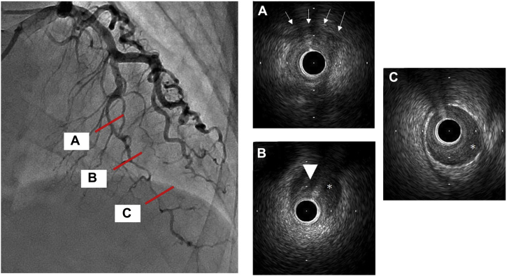 Figure 3