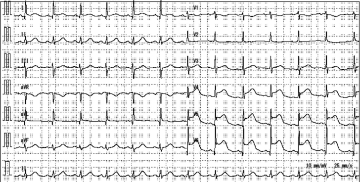 Figure 1