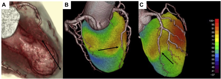 Figure 4