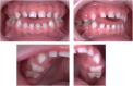 Fig. 11