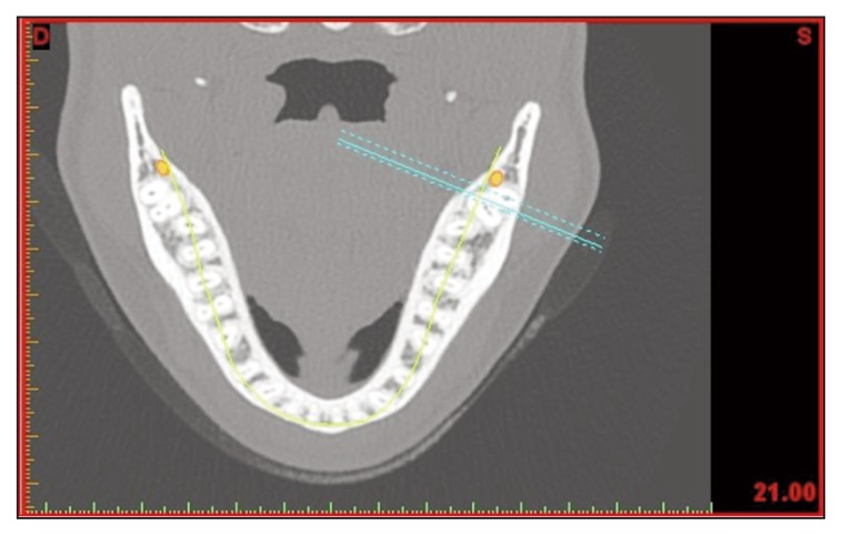 Figure 9