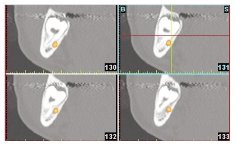 Figure 10