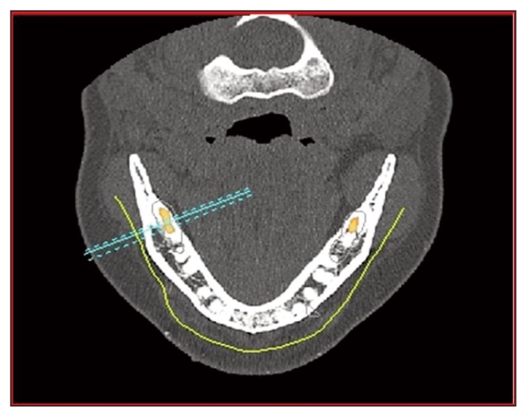 Figure 15