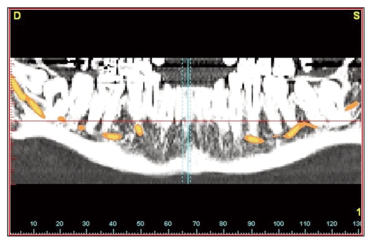 Figure 14