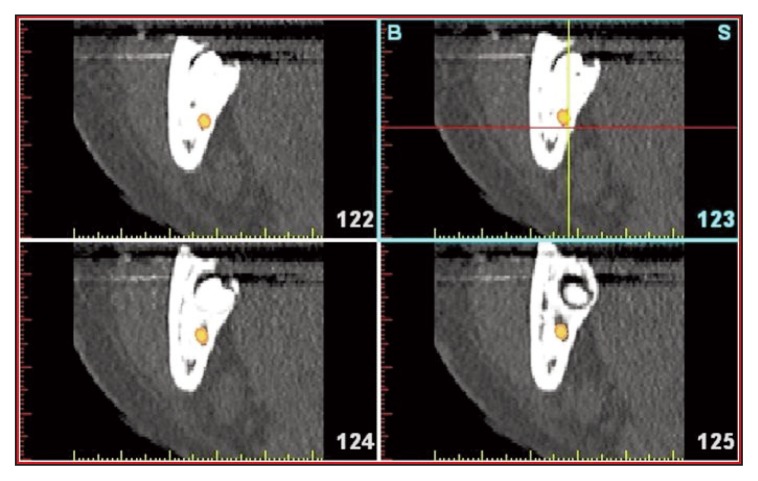 Figure 19