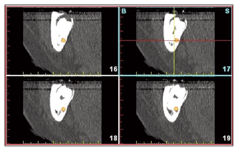 Figure 16