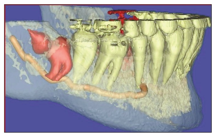 Figure 17