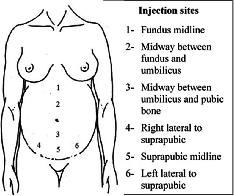 Fig. 2