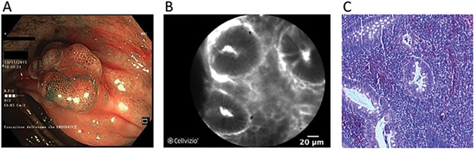 Fig 2