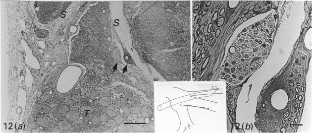 Fig. 12