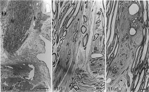 Fig. 11