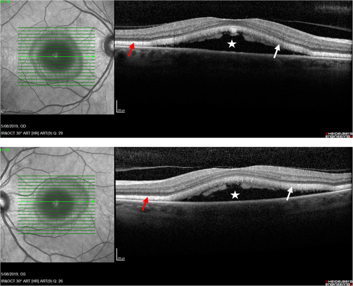 Fig. 3