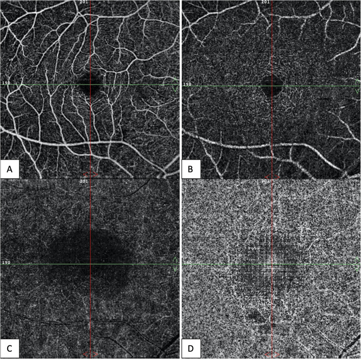 Fig. 4