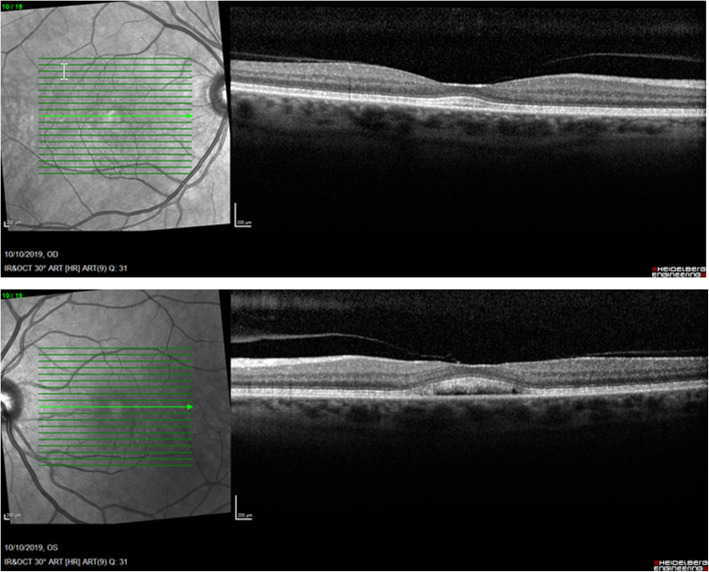 Fig. 6