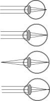 Fig 4: