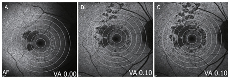 Fig. 2