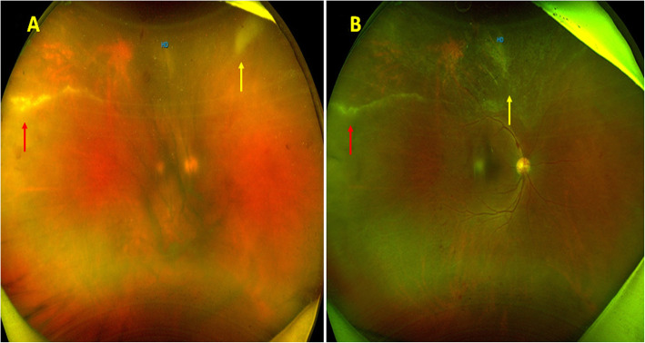 Fig. 2