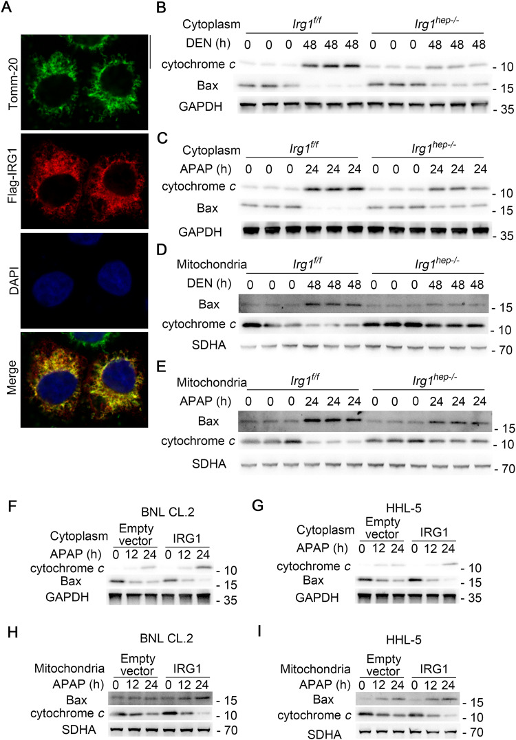 Mitochondrial IRG1 traps MCL-1 to induce hepatocyte apoptosis and ...