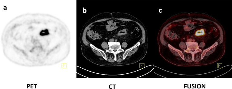 Figure 3