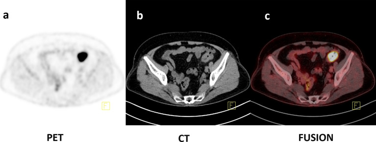 Figure 4