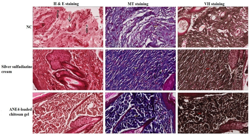 Figure 11