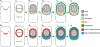 Fig 1.