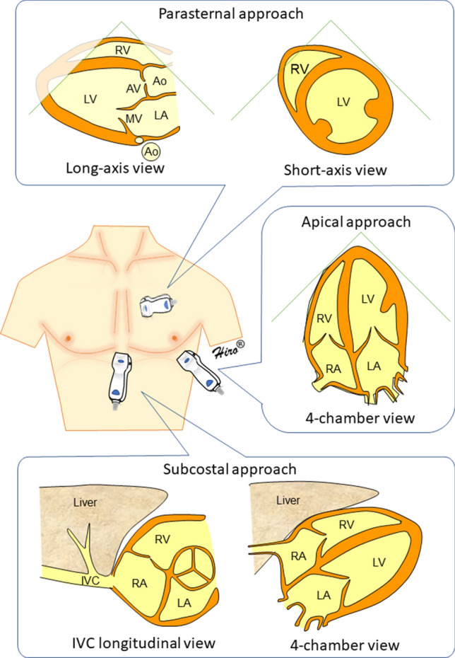 Fig. 1