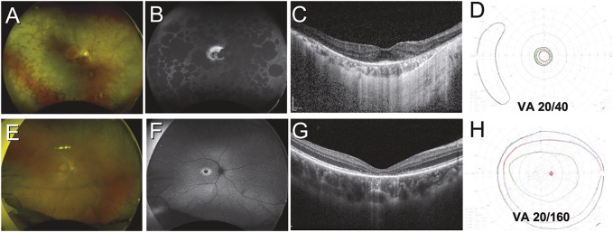 FIGURE 2