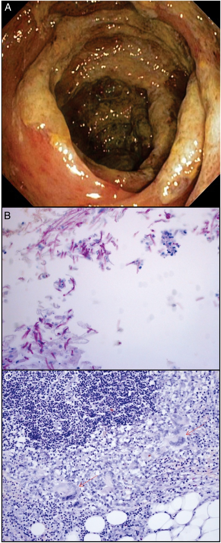 Figure 1