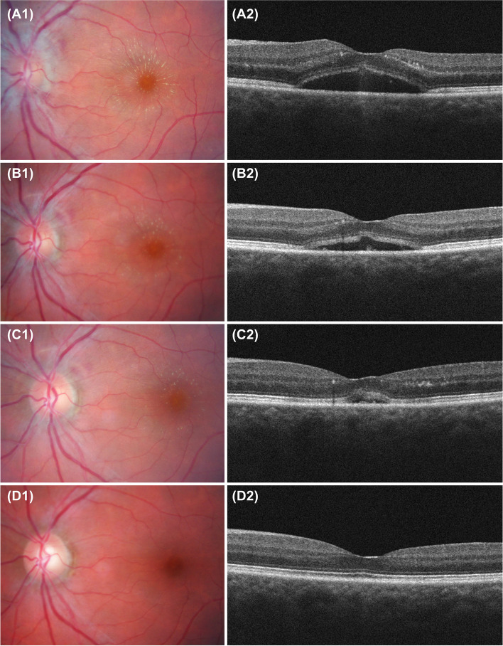 Fig. 1