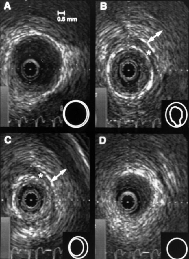 Figure 2  