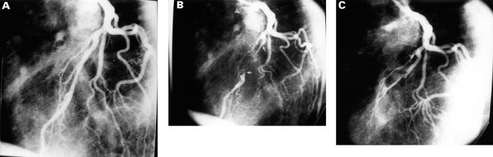 Figure 1  