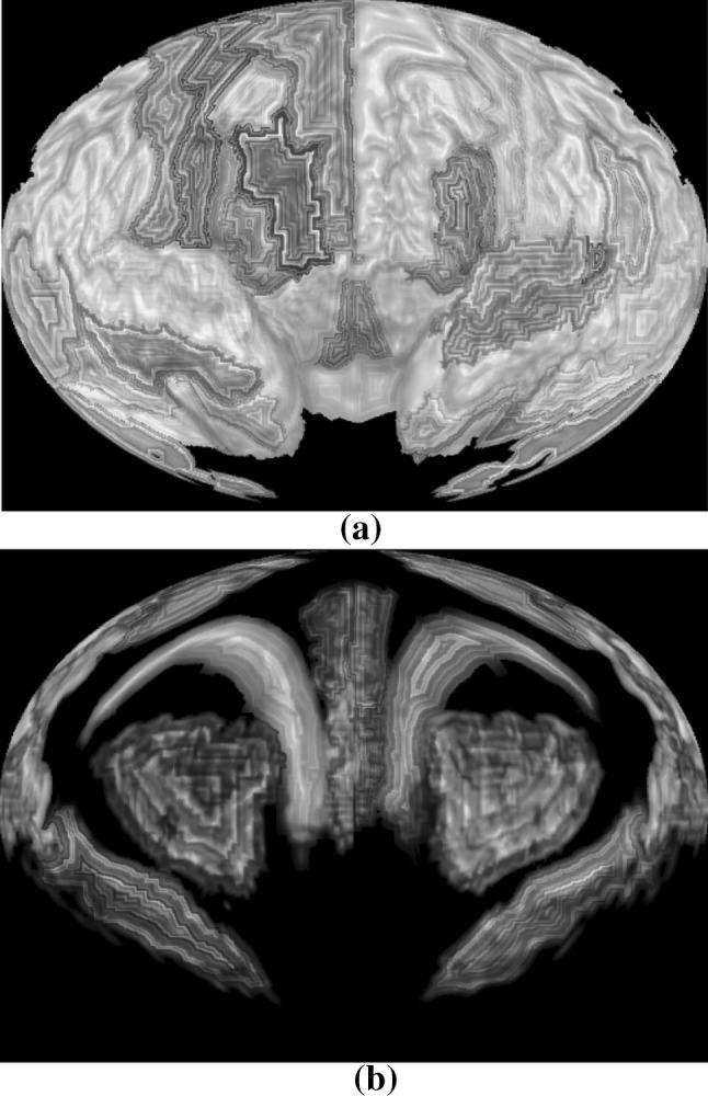 Fig. 12