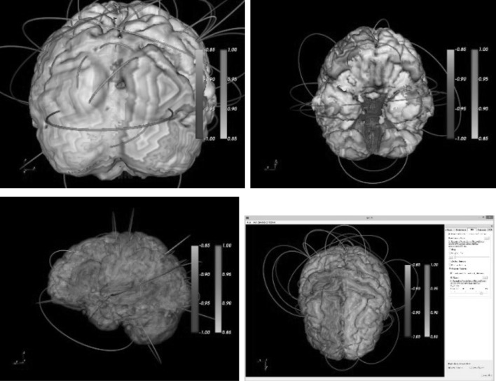 Fig. 5