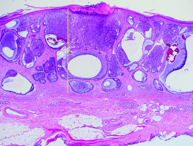 Figure 1C