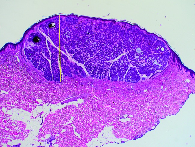 Figure 1B