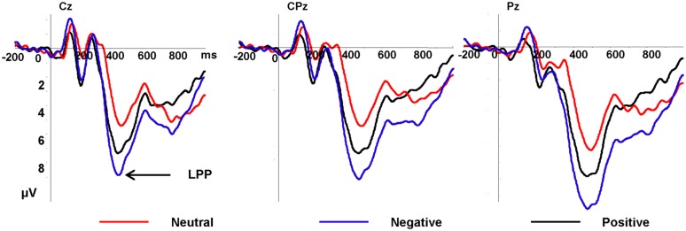 FIGURE 3