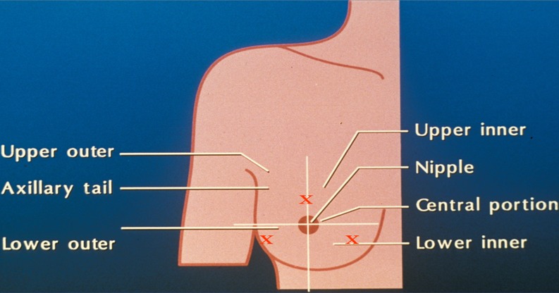 Fig. 10