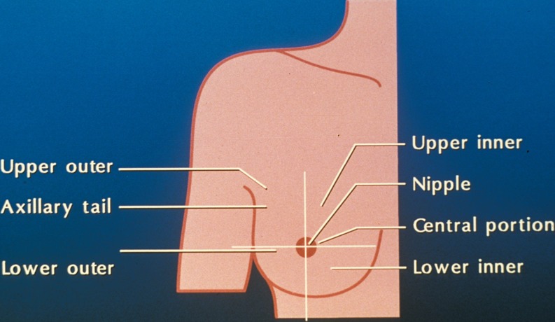 Fig. 15