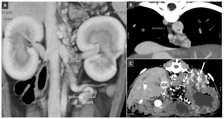 Figure 18