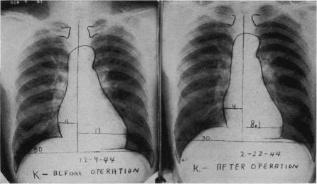 Fig. 16.