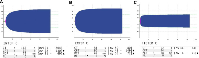 Fig. 2