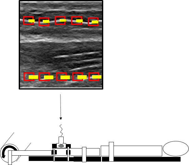 FIGURE 3