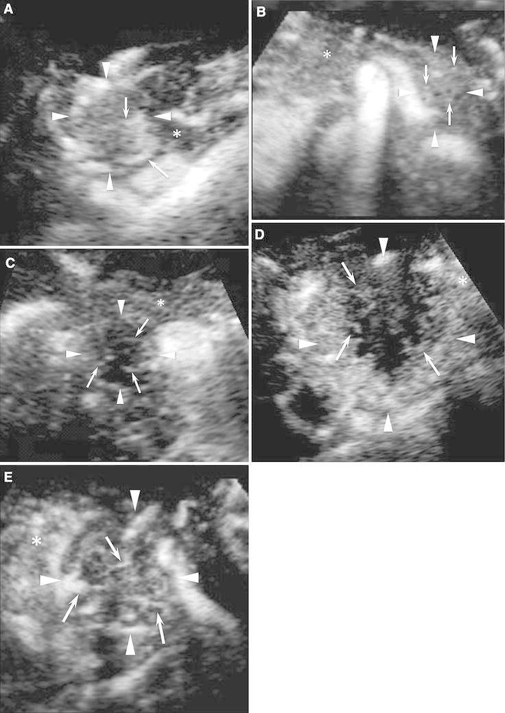 Fig. 4