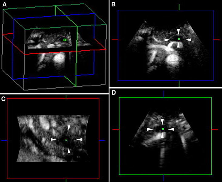 Fig. 2