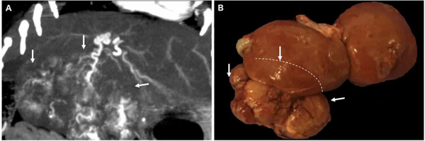 Figure 1: